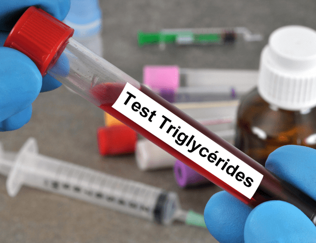 Alteración de triglicéridos, colesterol y ácido úrico en CDMX