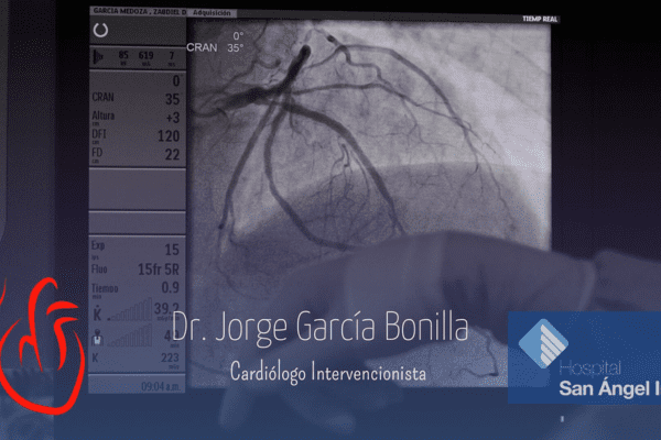 Radio Cardiología CDMX